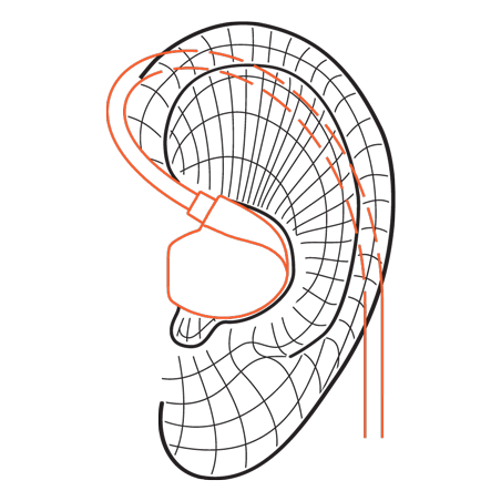 earhook-diagram
