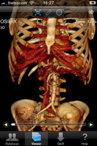 Osirix per iPhone